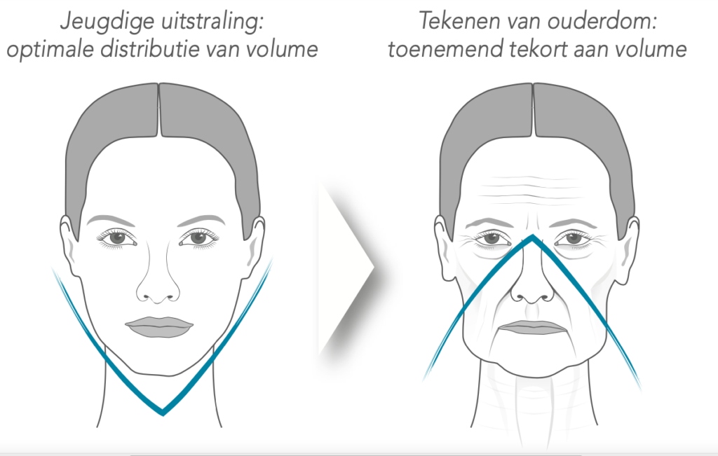 het verouderingsproces van ons gezicht